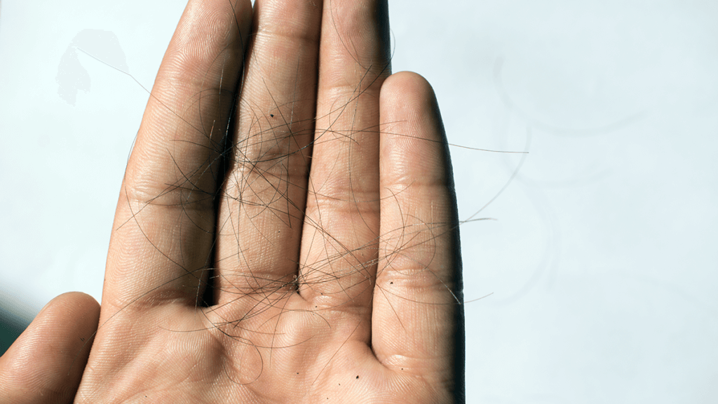 Hair-loss-concept-hand-hero-1200-675px